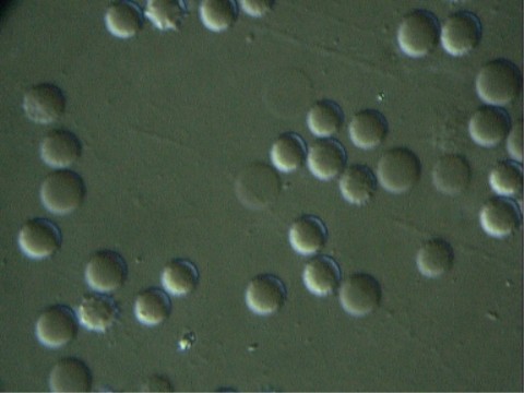 Normalzustand-Erythrozyten schwimmen frei